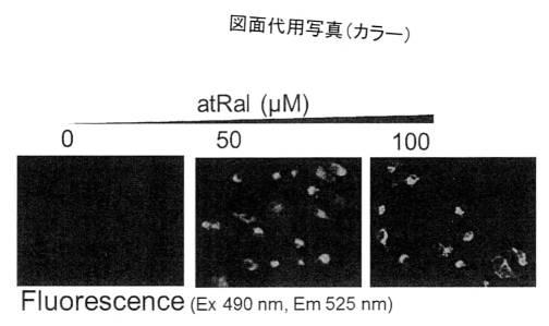 2016160263-加齢黄斑変性症予防薬 図000002