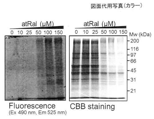 2016160263-加齢黄斑変性症予防薬 図000003