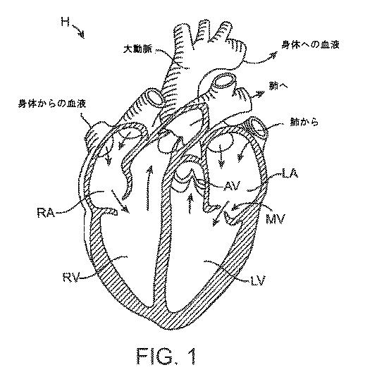 2019022777-心臓弁置換のためのデバイス、システムおよび方法 図000003