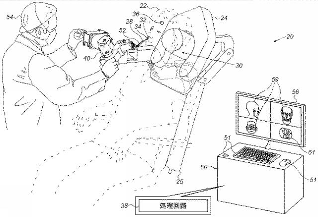 2020168368-医療器具の識別 図000003