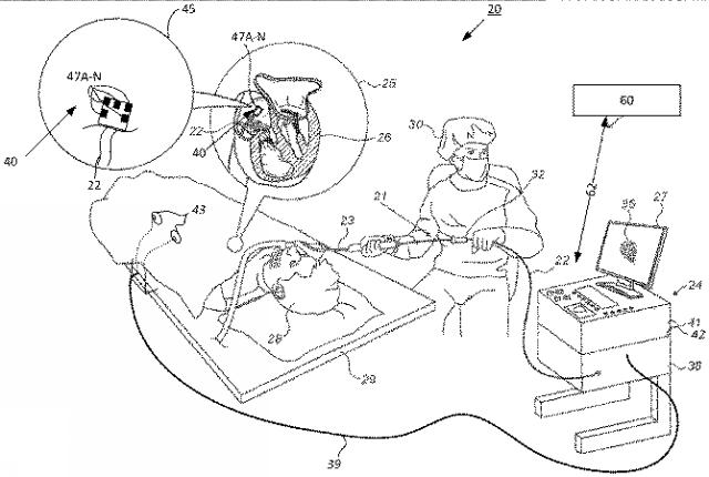 2021094390-電極のサブセットに基づく組織近接性表示 図000003