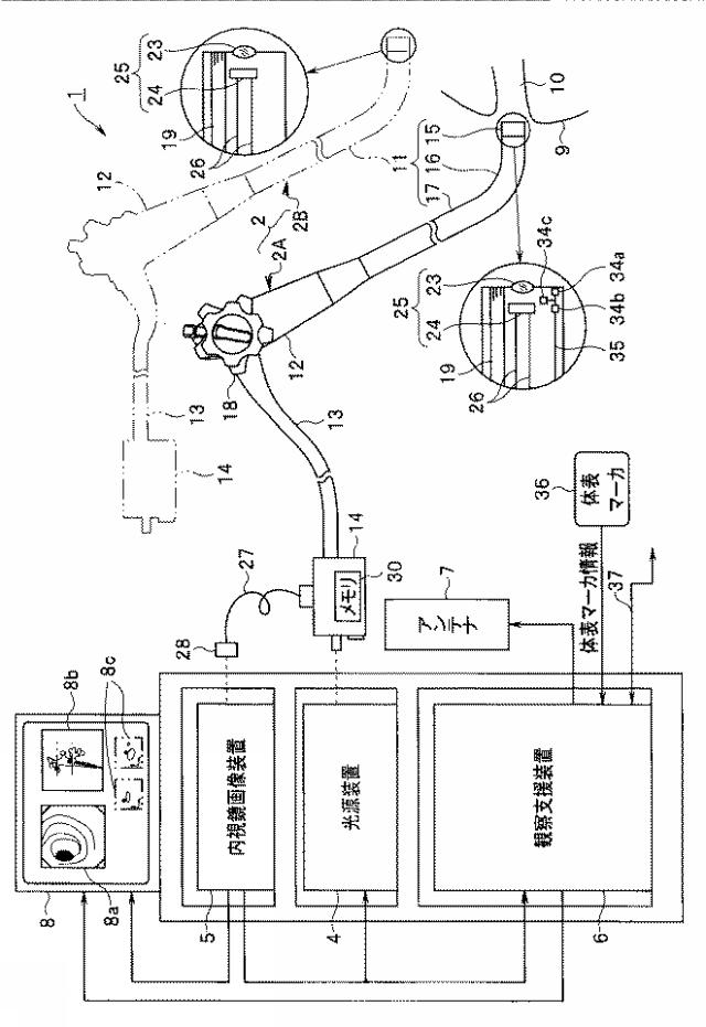 2017225700-観察支援装置及び内視鏡システム 図000004