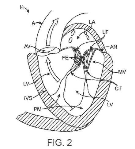 2019022777-心臓弁置換のためのデバイス、システムおよび方法 図000004