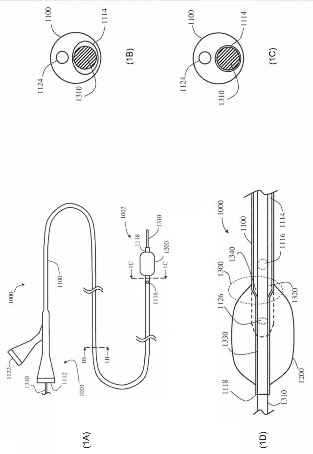 2019162472-ガイドワイヤーバルブを備える注入カテーテル 図000004