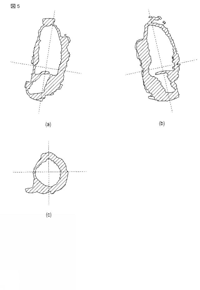 2015231436-超音波診断装置及び医用画像処理装置 図000005