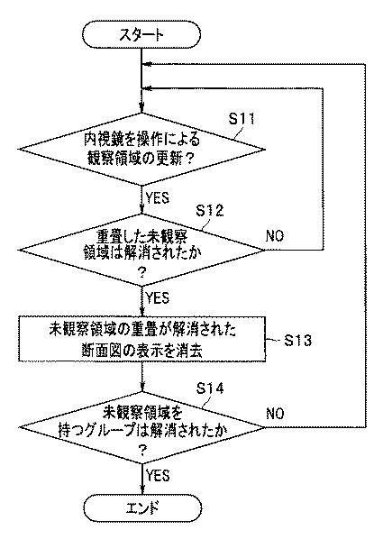 2017225700-観察支援装置及び内視鏡システム 図000006