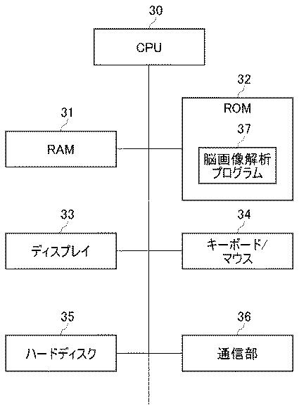 2018077164-脳画像解析方法、脳画像解析装置、およびプログラム 図000006