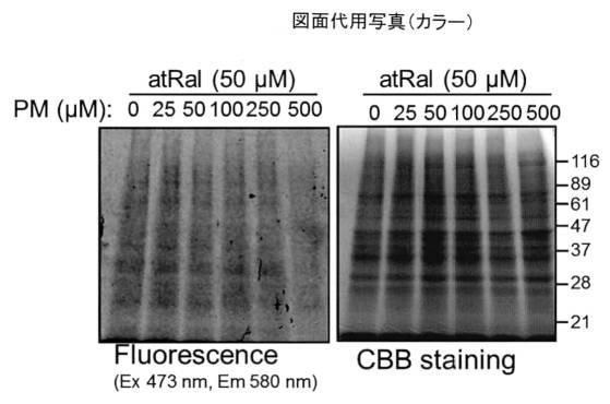 2016160263-加齢黄斑変性症予防薬 図000007