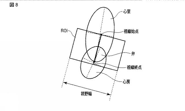 2015231436-超音波診断装置及び医用画像処理装置 図000008