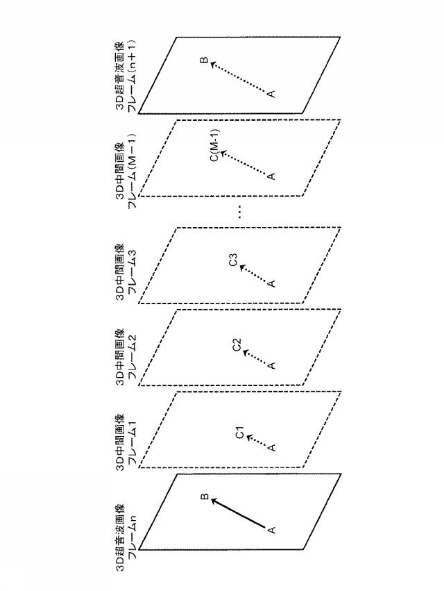 2016221076-超音波診断装置 図000008