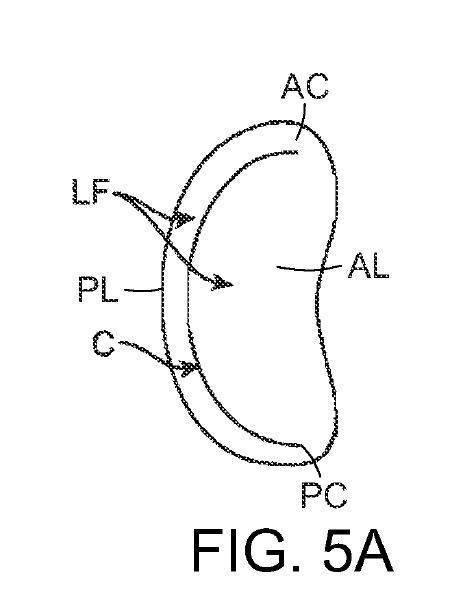 2019022777-心臓弁置換のためのデバイス、システムおよび方法 図000008