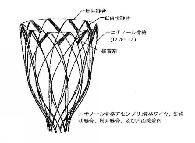 2015144827-心臓病態を治療するための補助及びリコイル機能を備える二相性及び動的調整可能サポートデバイス及び方法 図000009