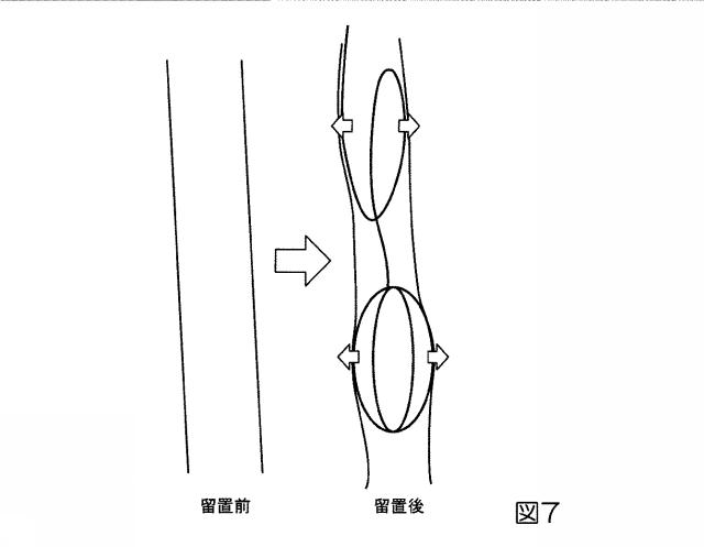 2017131344-医療用電気刺激電極および医療用電気刺激装置 図000009