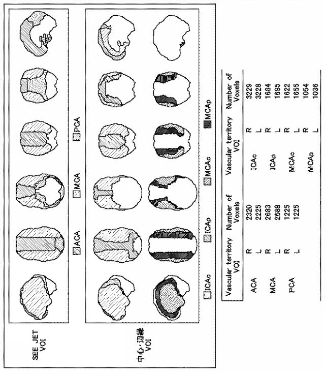 2018077164-脳画像解析方法、脳画像解析装置、およびプログラム 図000009