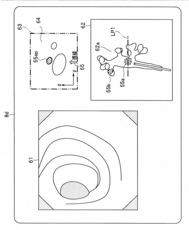 2017225700-観察支援装置及び内視鏡システム 図000011