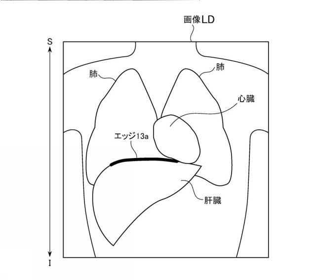 2019097820-磁気共鳴イメージング装置およびプログラム 図000011