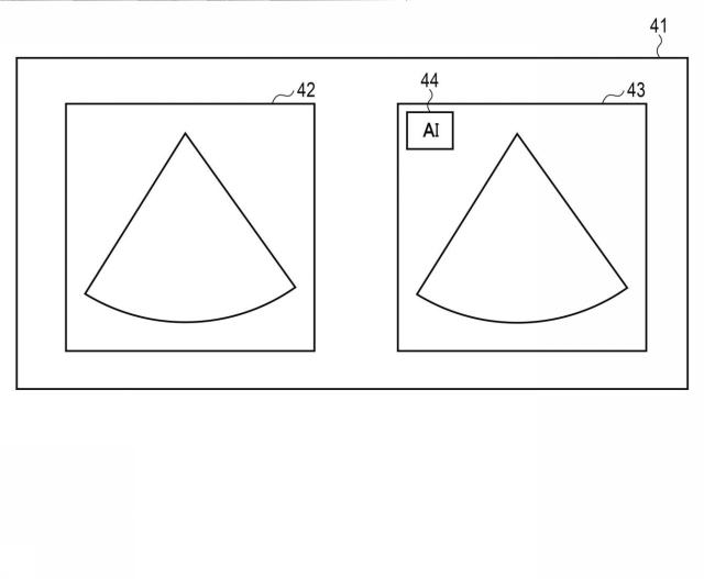 2020114293-超音波診断装置、及び学習プログラム 図000011
