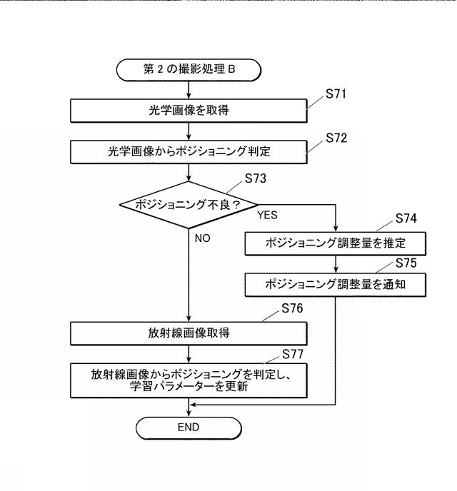 2021194388-放射線画像撮影システム、プログラム及び画像処理方法 図000011