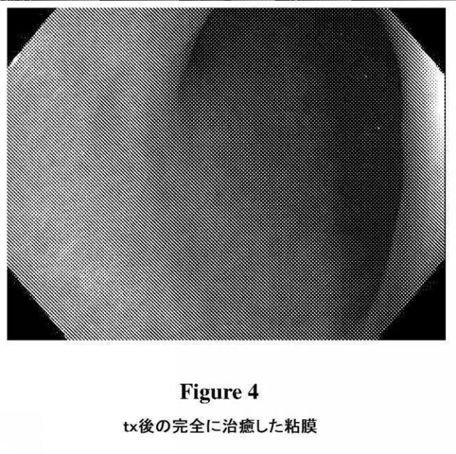 2017141303-クローン病および関連する状態および感染症を処置するための組成物および方法 図000012