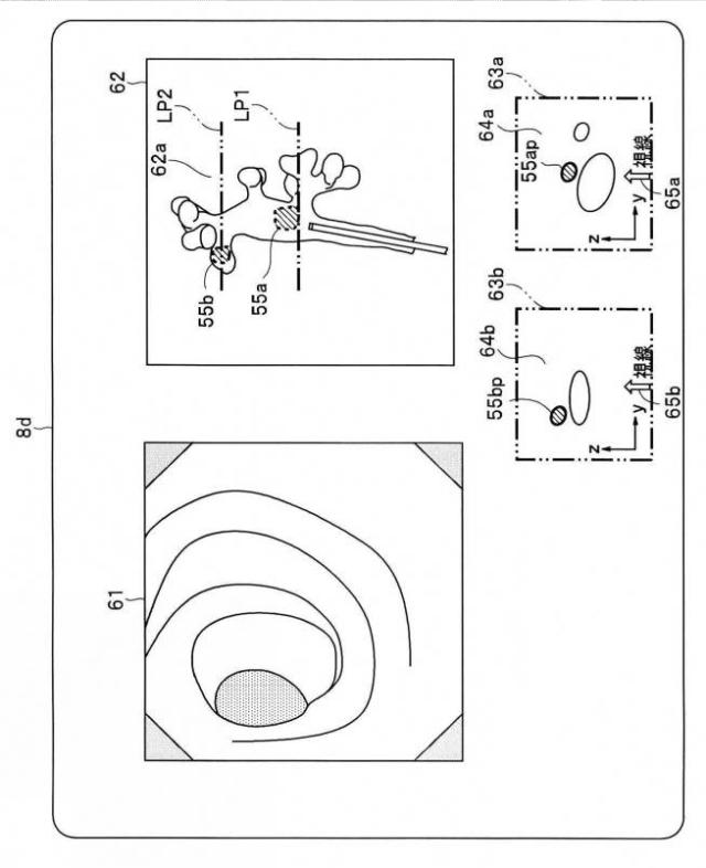 2017225700-観察支援装置及び内視鏡システム 図000012