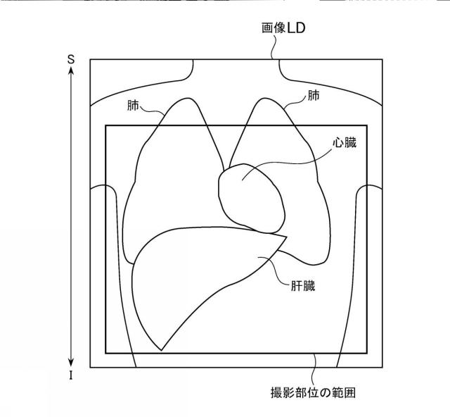 2019097820-磁気共鳴イメージング装置およびプログラム 図000012