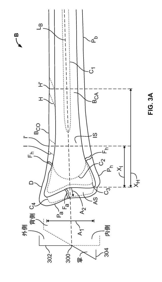2018114305-骨修復準備のための装置および方法 図000013