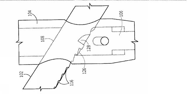 2018187457-髄内転子間固定インプラント用の一方向摺動装置 図000013