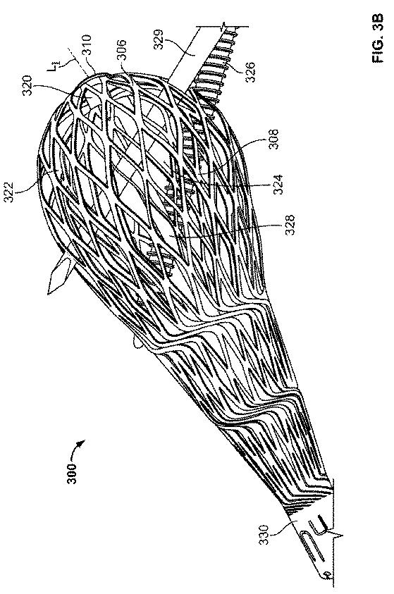 2018114305-骨修復準備のための装置および方法 図000014