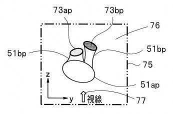 2017225700-観察支援装置及び内視鏡システム 図000015