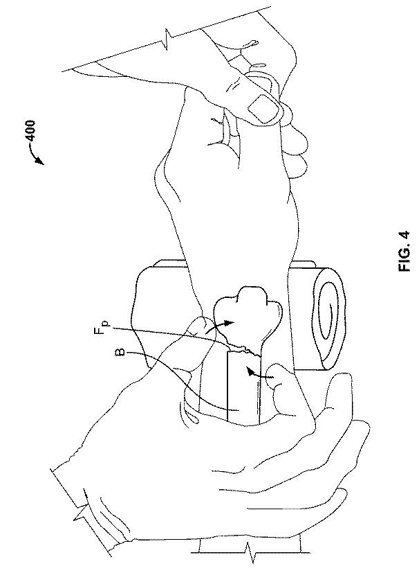 2018114305-骨修復準備のための装置および方法 図000015