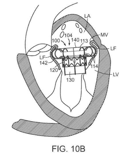 2019022777-心臓弁置換のためのデバイス、システムおよび方法 図000017