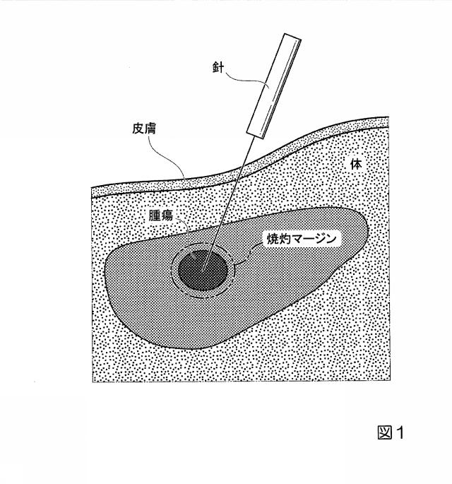 2019033960-生体内運動追跡装置、生体内運動追跡方法およびプログラム 図000018