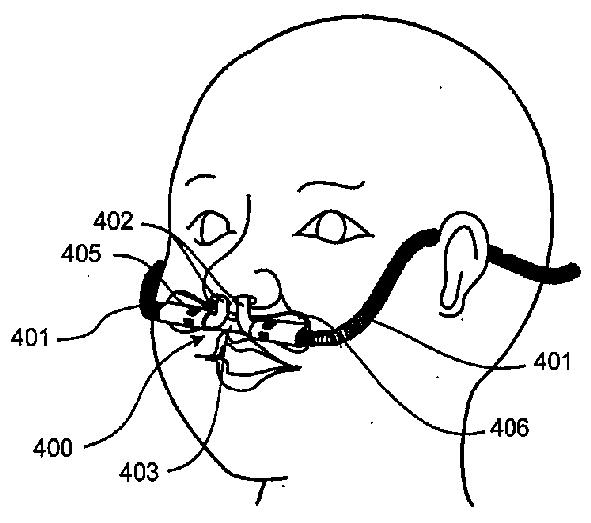 2019213869-鼻カニューレ、導管及び固定システム 図000018
