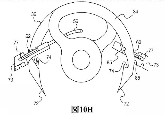 2017200593-回転針を用いた皮膚縫合装置 図000019