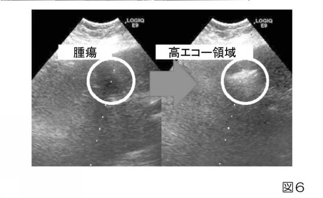 2019033960-生体内運動追跡装置、生体内運動追跡方法およびプログラム 図000023
