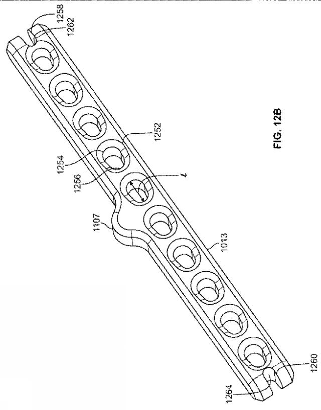 2018114305-骨修復準備のための装置および方法 図000024