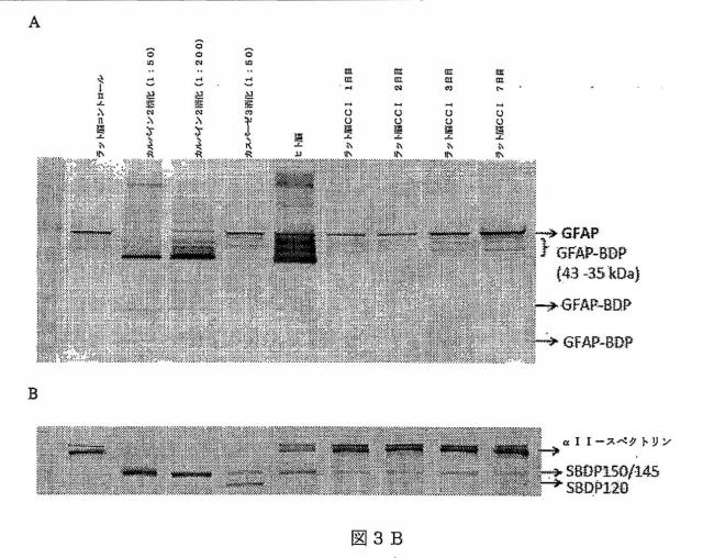2016105097-ニューロン損傷診断のためのマイクロＲＮＡ、自己抗体およびタンパク質マーカー 図000026