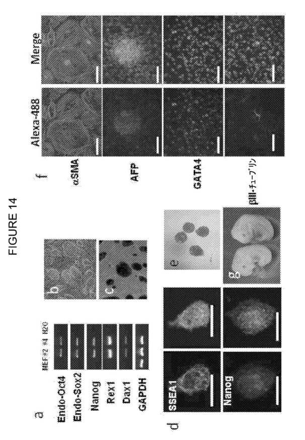 2017212985-ＺＳＣＡＮ４とＺＳＣＡＮ４依存性遺伝子を利用した体細胞の直接的な再プログラム化 図000026