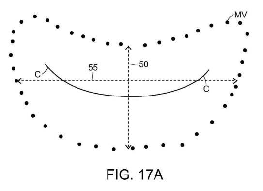 2019022777-心臓弁置換のためのデバイス、システムおよび方法 図000027