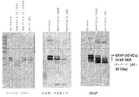2016105097-ニューロン損傷診断のためのマイクロＲＮＡ、自己抗体およびタンパク質マーカー 図000028