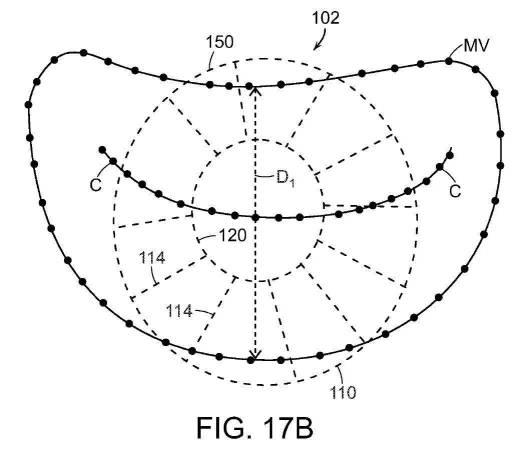 2019022777-心臓弁置換のためのデバイス、システムおよび方法 図000028