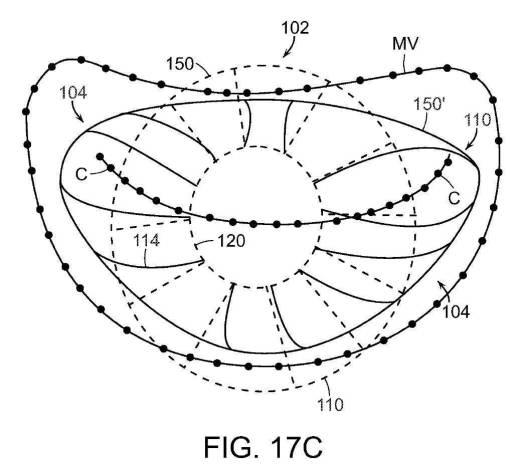 2019022777-心臓弁置換のためのデバイス、システムおよび方法 図000029