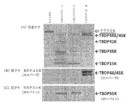 2016105097-ニューロン損傷診断のためのマイクロＲＮＡ、自己抗体およびタンパク質マーカー 図000030