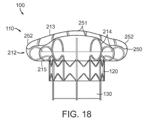 2019022777-心臓弁置換のためのデバイス、システムおよび方法 図000030