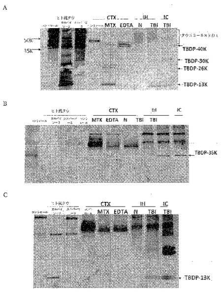 2016105097-ニューロン損傷診断のためのマイクロＲＮＡ、自己抗体およびタンパク質マーカー 図000031