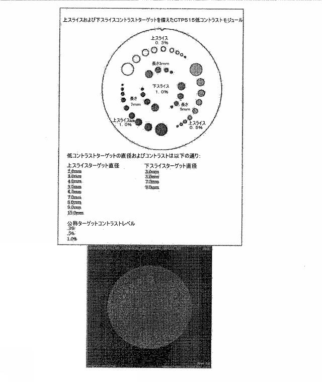 2015061642-放射線画像システム用拡張型低コントラスト検出能 図000034