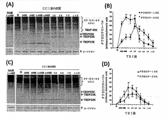 2016105097-ニューロン損傷診断のためのマイクロＲＮＡ、自己抗体およびタンパク質マーカー 図000034