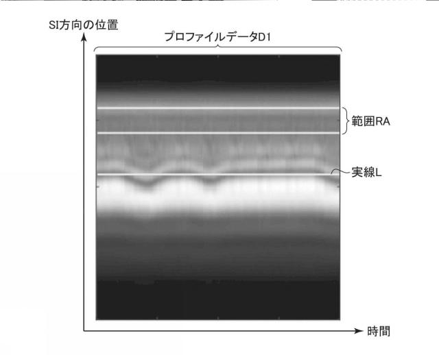 2019097820-磁気共鳴イメージング装置およびプログラム 図000034