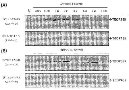 2016105097-ニューロン損傷診断のためのマイクロＲＮＡ、自己抗体およびタンパク質マーカー 図000035