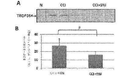 2016105097-ニューロン損傷診断のためのマイクロＲＮＡ、自己抗体およびタンパク質マーカー 図000037